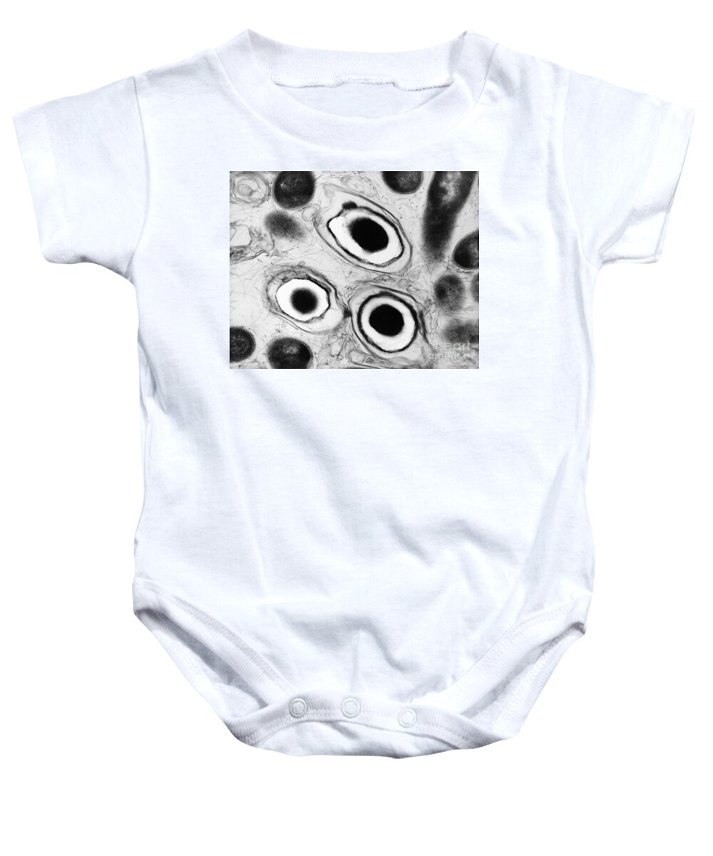 Haemophilus Baby Onesie featuring the photograph Bacterial Endospore, Tem by David M. Phillips