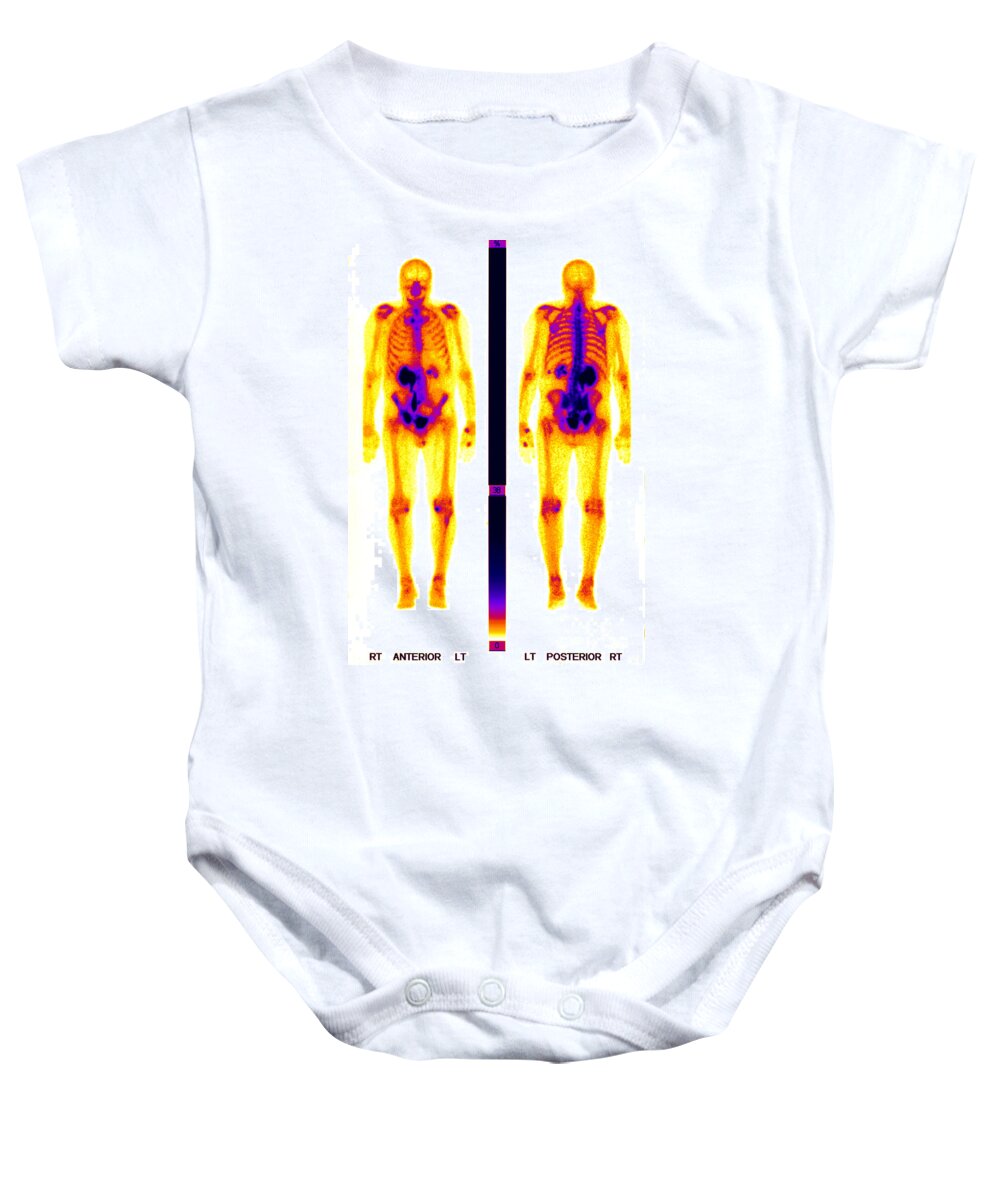 Biology Baby Onesie featuring the photograph Nuclear Medicine #2 by Ted Kinsman