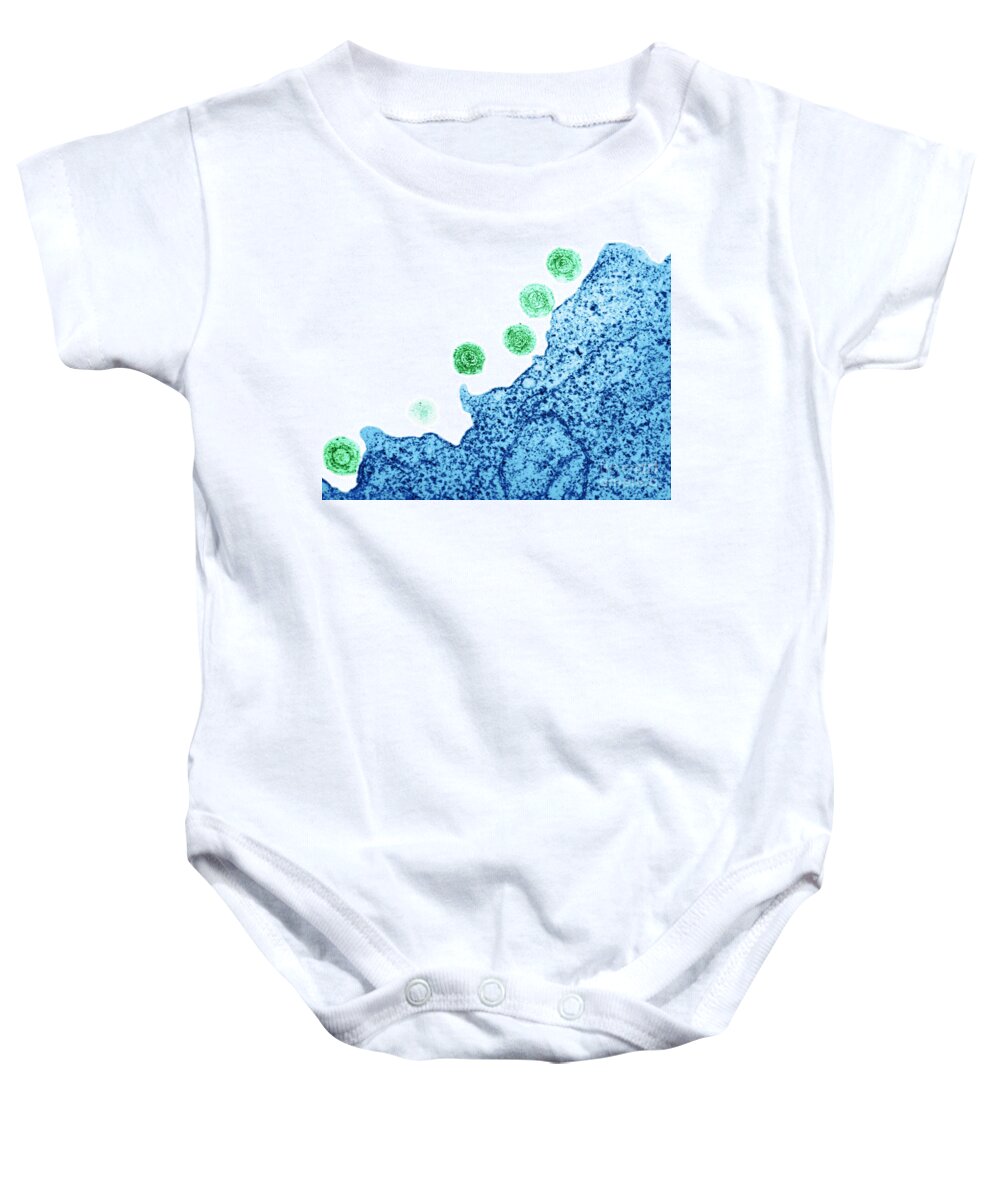 Dna Virus Baby Onesie featuring the photograph Human Herpes Virus-6 #3 by Science Source