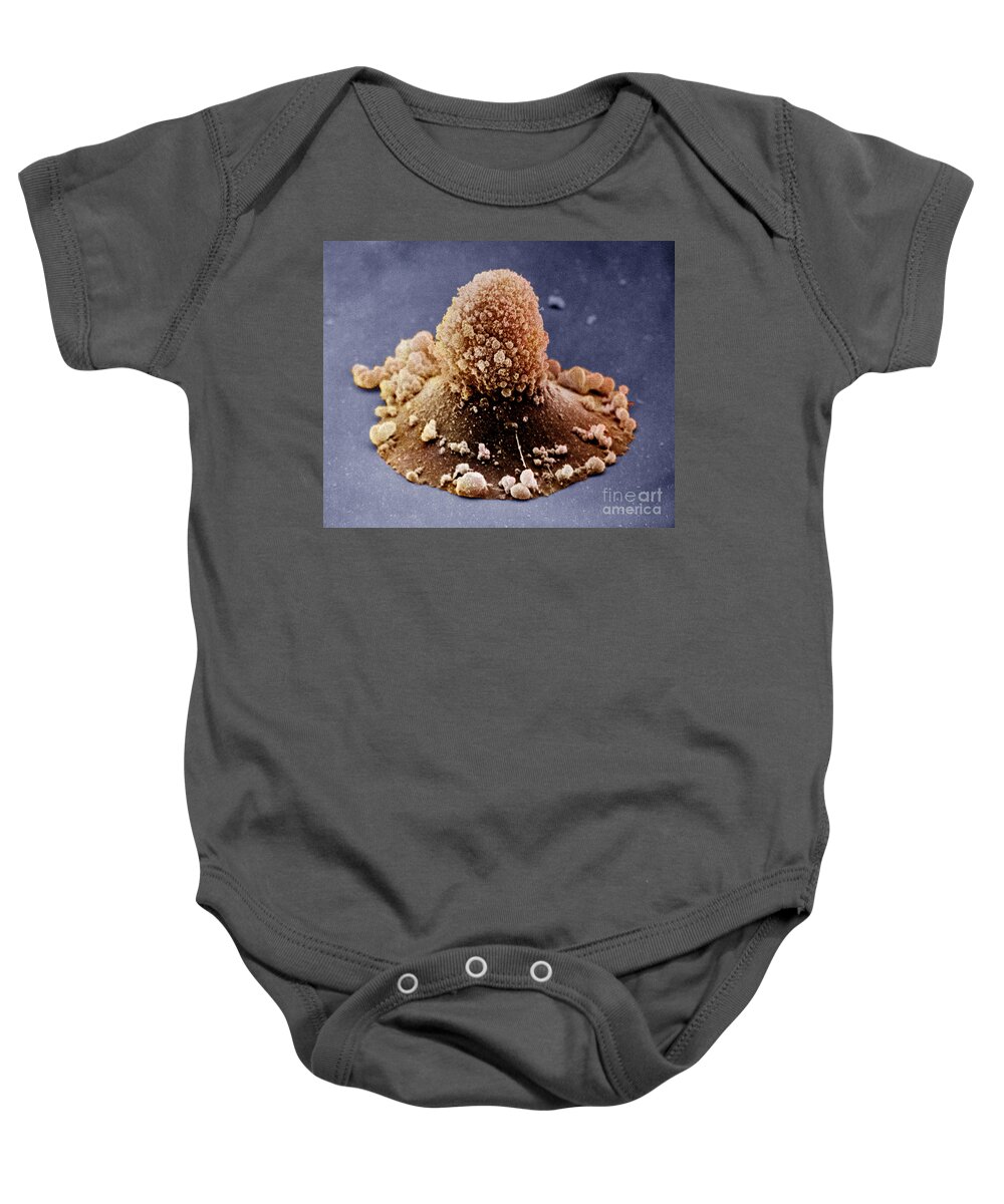 Apobodies Baby Onesie featuring the photograph Carcinoma Cell Apoptosis #1 by David M. Phillips