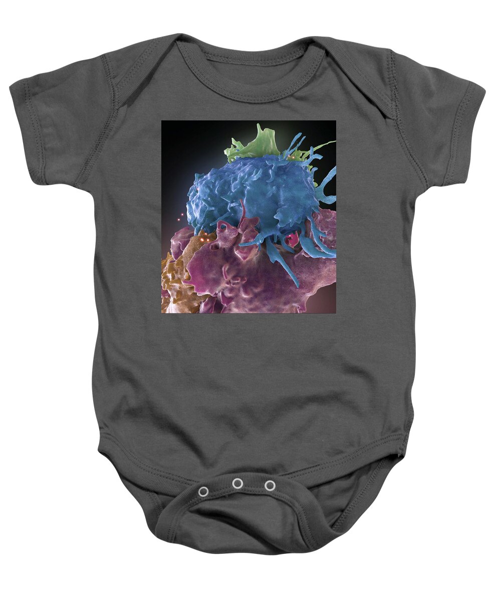 Science Baby Onesie featuring the photograph Hiv-infected And Normal T Cells by Science Source