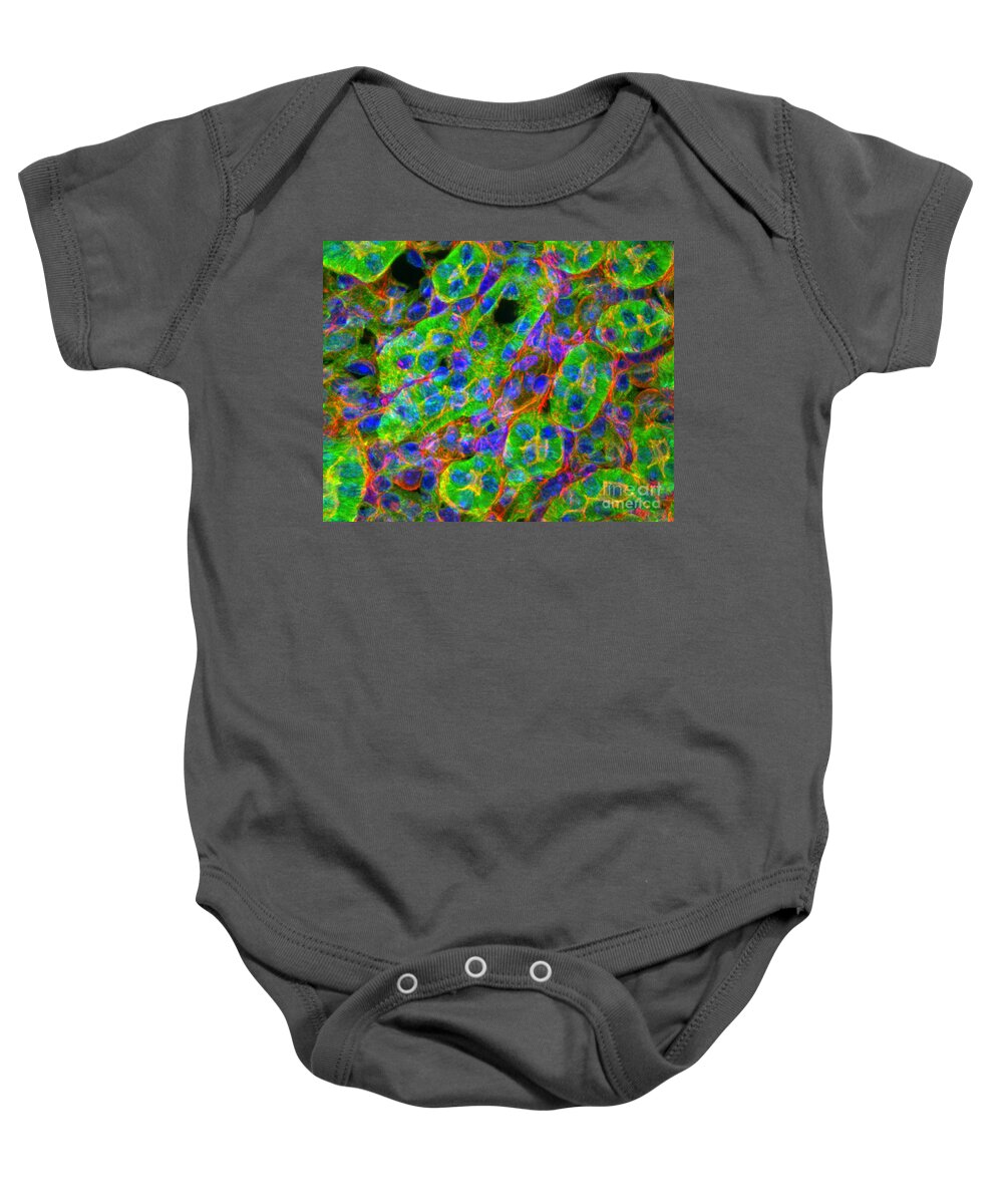 Light Micrograph Baby Onesie featuring the photograph Light Micrograph Of Kidney Tissue by Lauren Piedmont