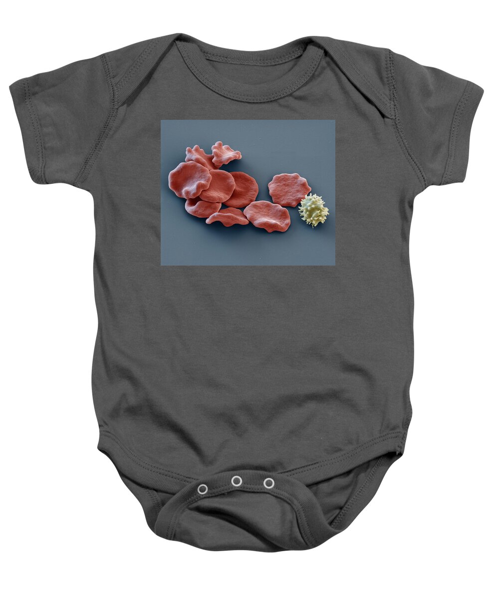 Blood Baby Onesie featuring the photograph Red Blood Cells And Lymphocyte, Sem by Eye of Science