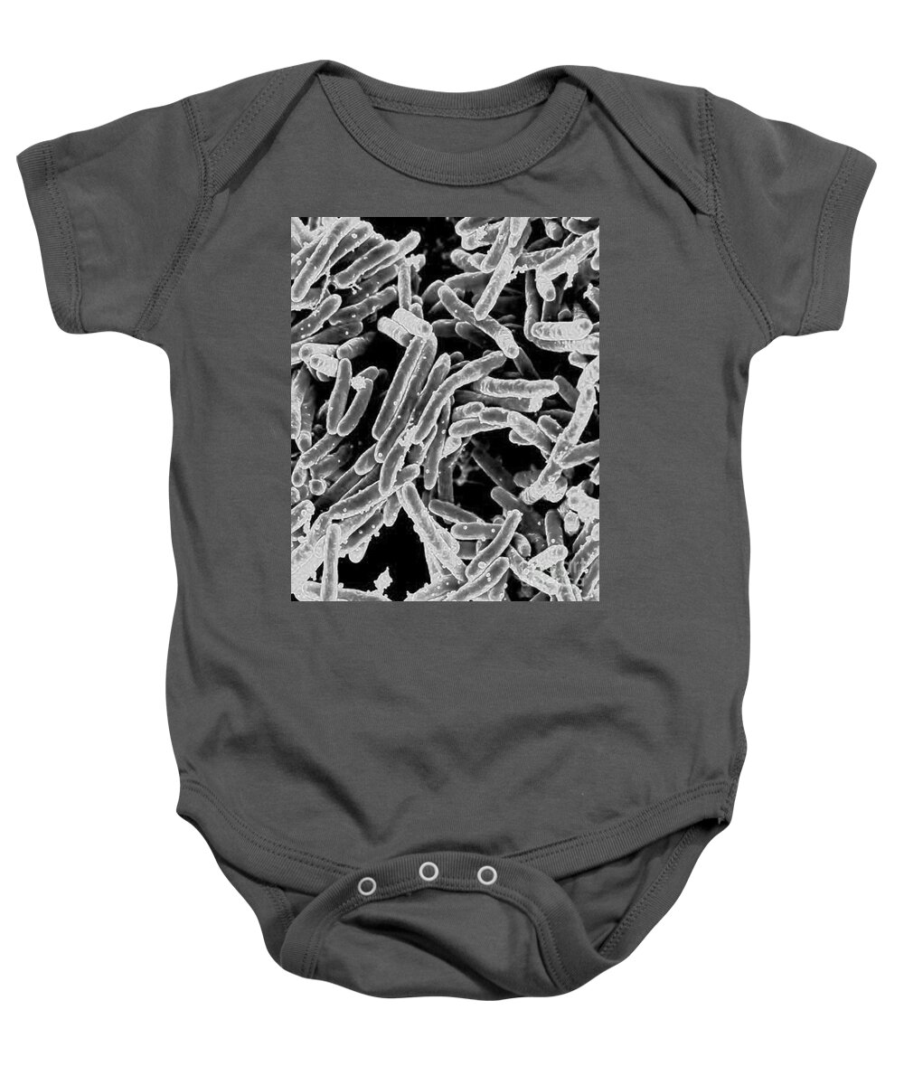 Microbiology Baby Onesie featuring the photograph Mycobacterium Tuberculosis Bacteria, Sem by Science Source