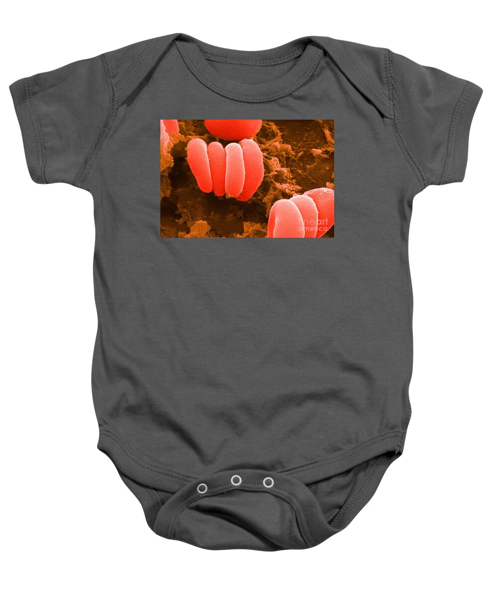 Biology Baby Onesie featuring the photograph Red Blood Cells, Rouleaux Formation, Sem by Science Source