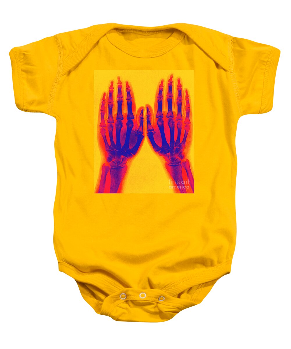 Historic Baby Onesie featuring the photograph X-ray Of Two Normal Hands 1896 #3 by Science Source