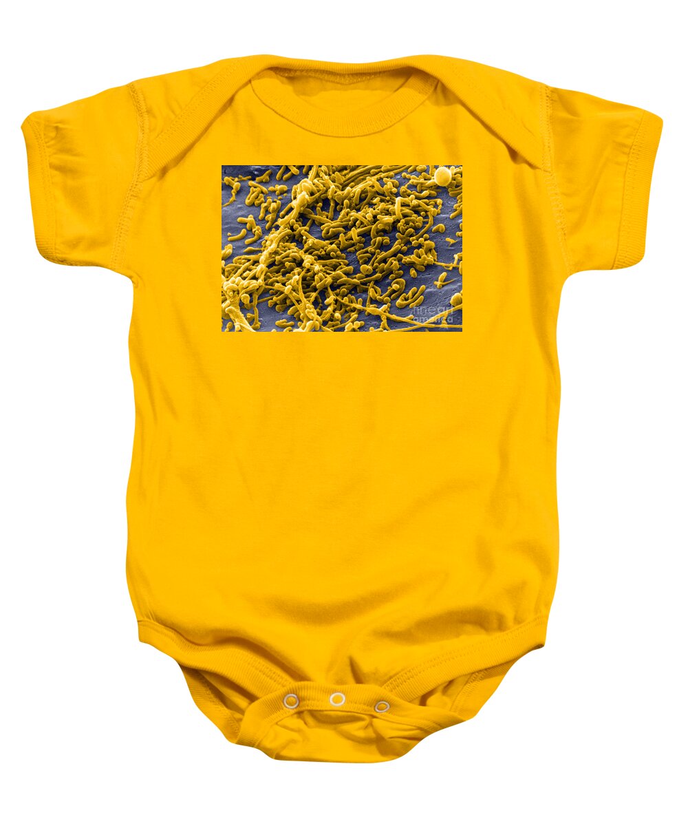Bacterial Baby Onesie featuring the photograph Mycoplasma Bacteria, Sem #3 by David M. Phillips
