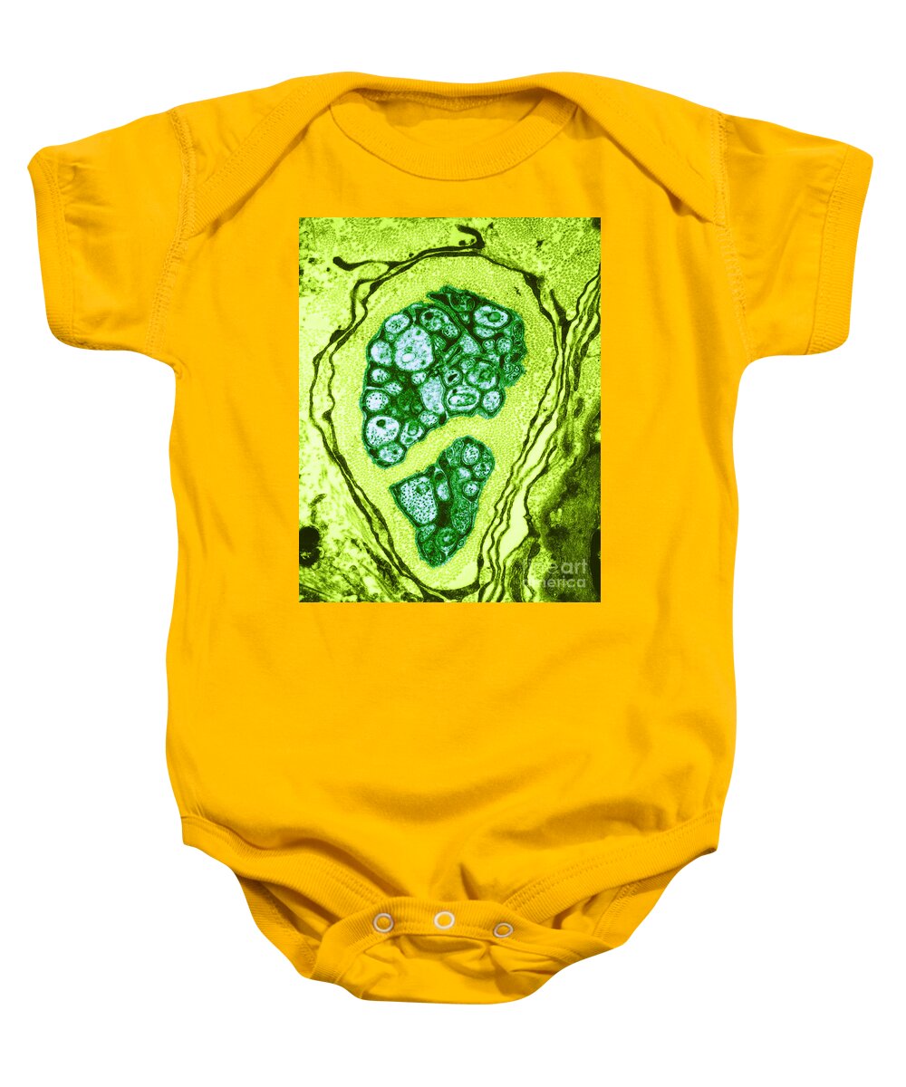 Microscopy Baby Onesie featuring the photograph Nerve Cell Axons, Tem by David M. Phillips