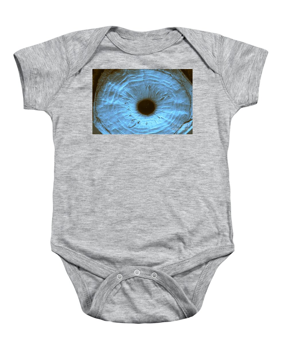 Anterior Segment Baby Onesie featuring the photograph Anterior Surface Of Iris, Sem #1 by Ralph C. Eagle, Jr.
