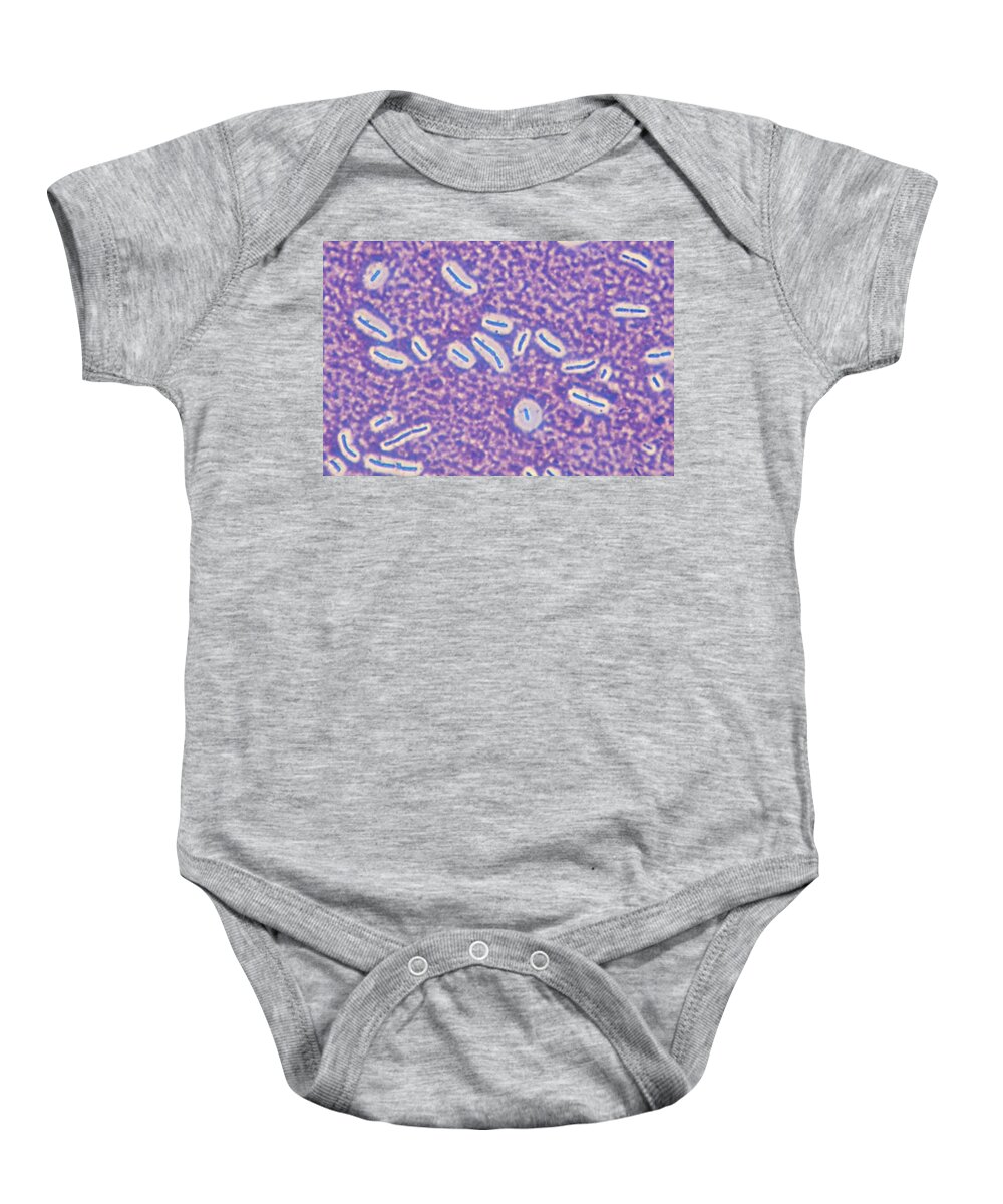 Science Baby Onesie featuring the photograph Bacterial Capsules, Lm #1 by Michael Abbey