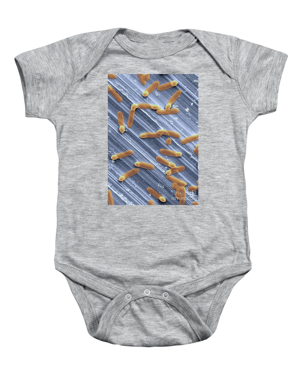 Bacterial Spores Baby Onesie featuring the photograph Clostridium Difficile Bacteria #3 by Scimat