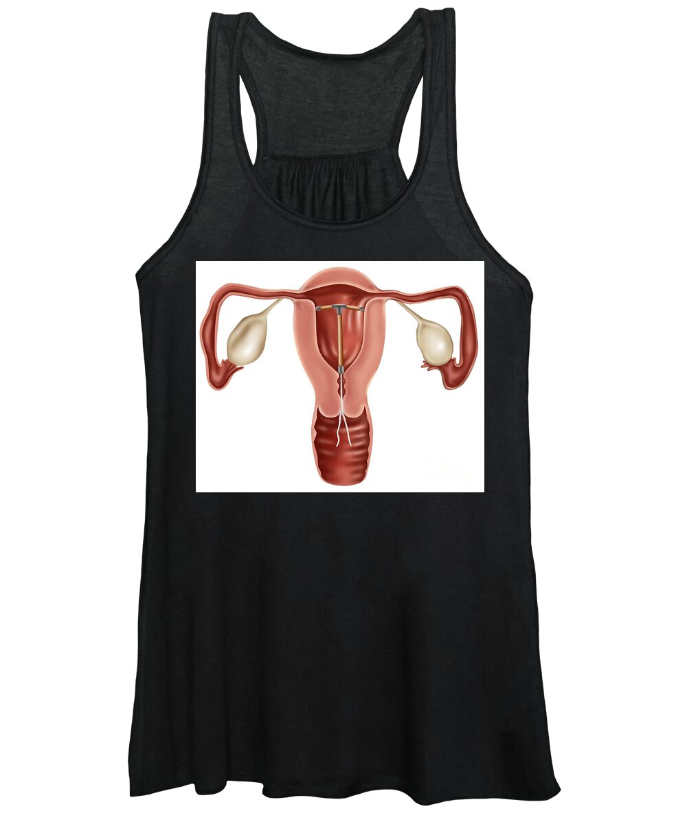 Anatomical Women's Tank Top featuring the photograph Iud Contraceptive #2 by Gwen Shockey