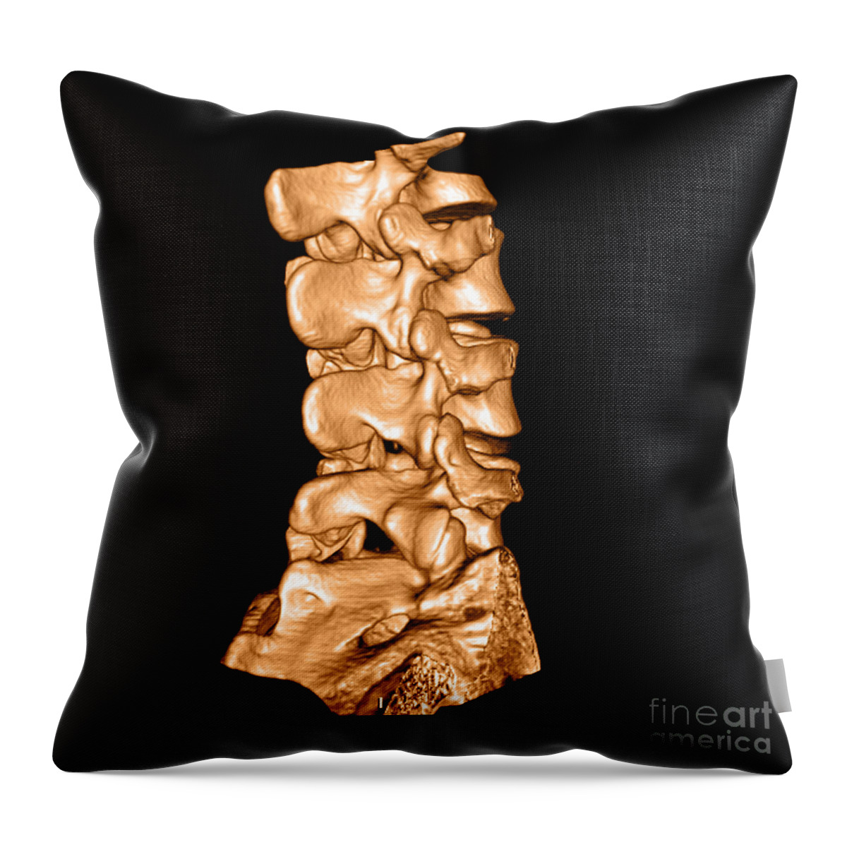 https://render.fineartamerica.com/images/rendered/default/throw-pillow/images-medium/2-3d-ct-of-lumbar-spine-medical-body-scans.jpg?&targetx=0&targety=0&imagewidth=479&imageheight=479&modelwidth=479&modelheight=479&backgroundcolor=151006&orientation=0&producttype=throwpillow-14-14