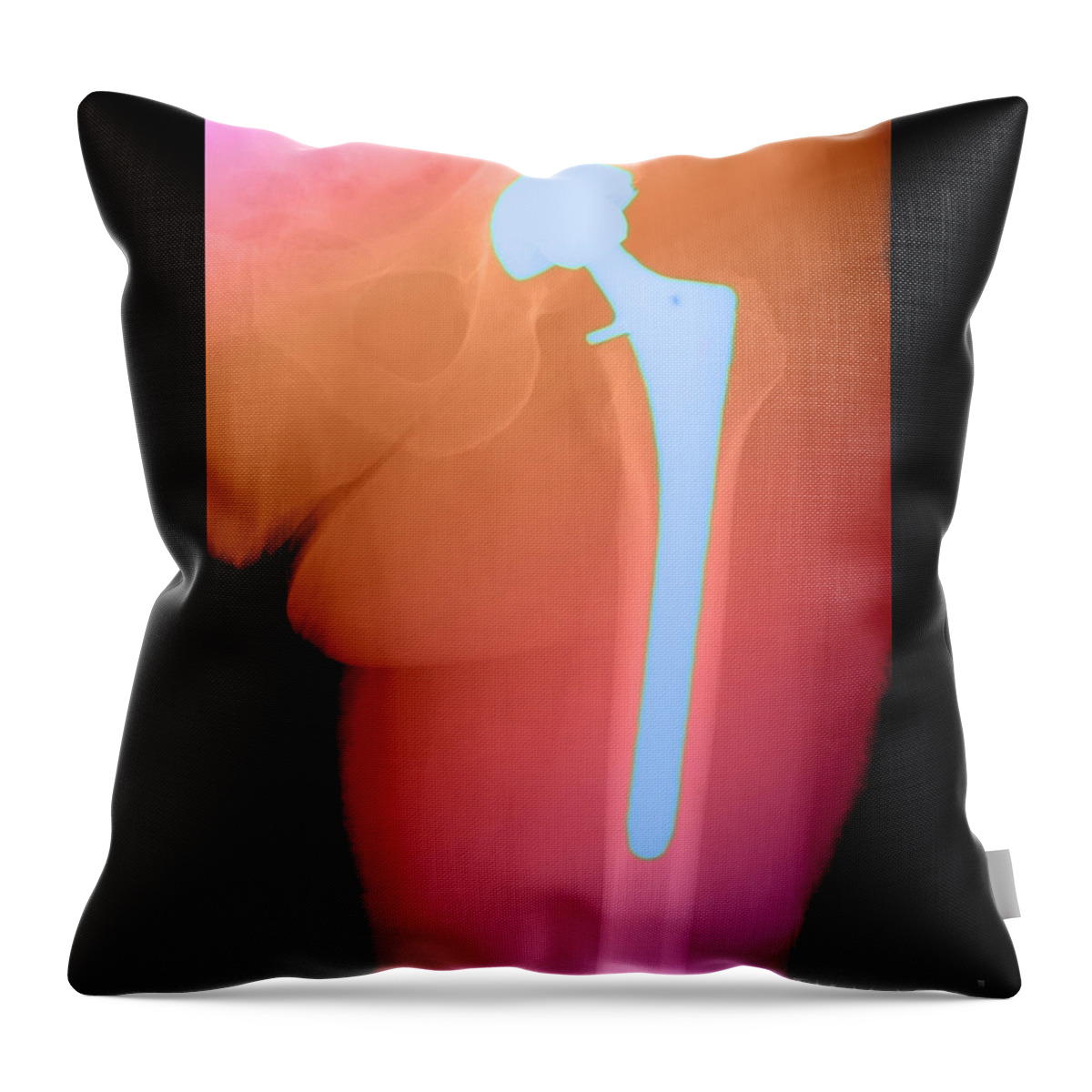 https://render.fineartamerica.com/images/rendered/default/throw-pillow/images-medium/3-hip-replacement-medical-body-scans.jpg?&targetx=0&targety=-51&imagewidth=479&imageheight=582&modelwidth=479&modelheight=479&backgroundcolor=581F05&orientation=0&producttype=throwpillow-14-14