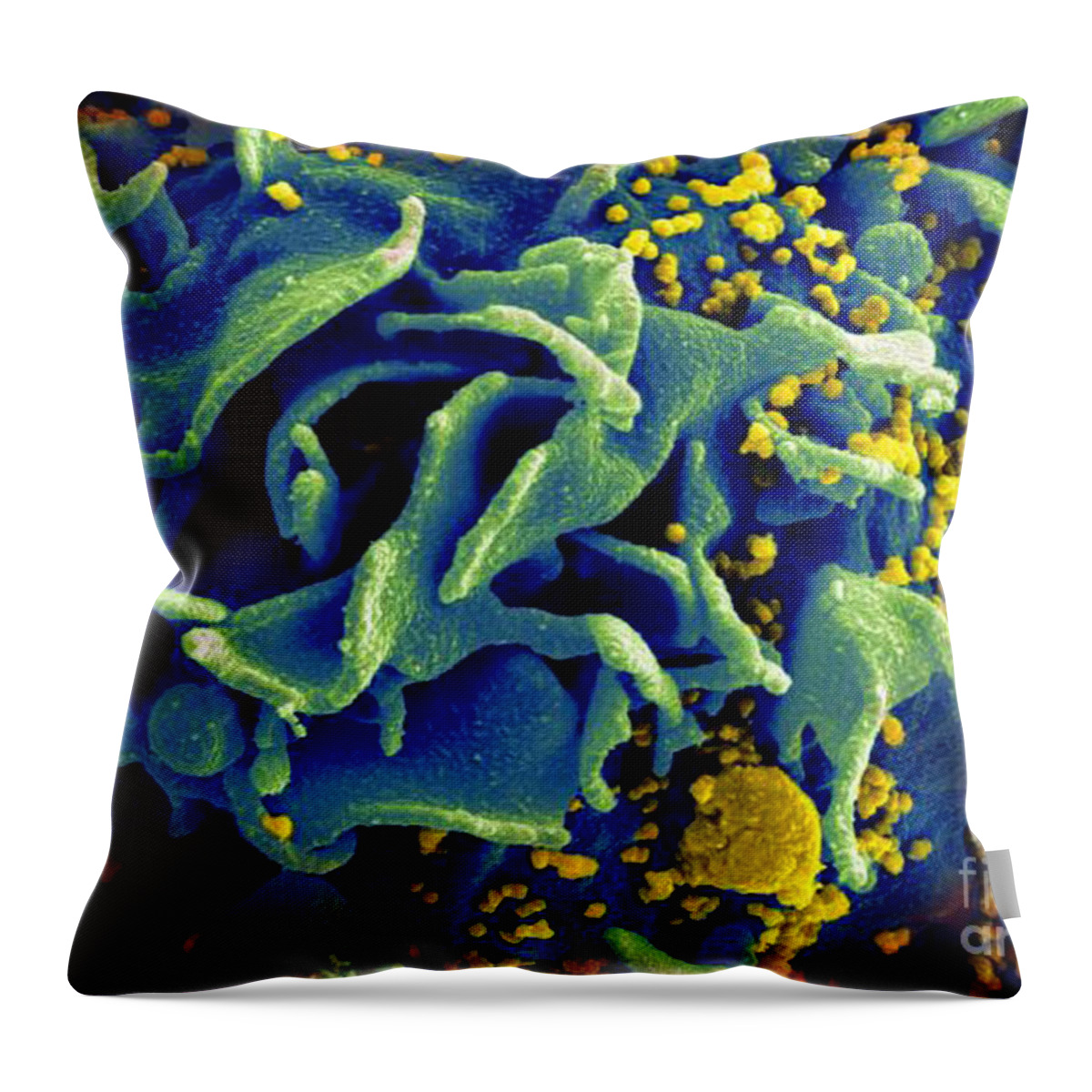 Microbiology Throw Pillow featuring the photograph Hiv-infected T Cell, Sem by Science Source