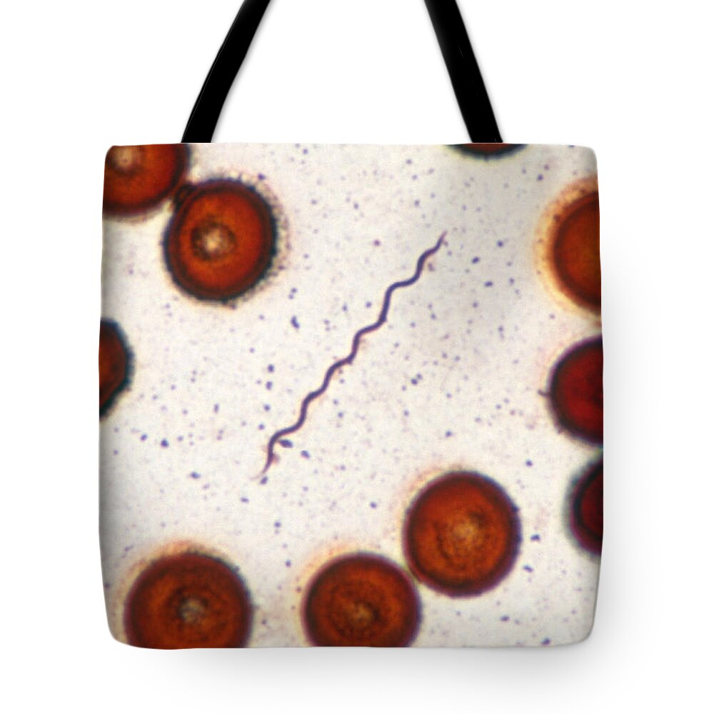 Bacteria Tote Bag featuring the photograph Borrelia Burgdorferi Lm #1 by Michael Abbey