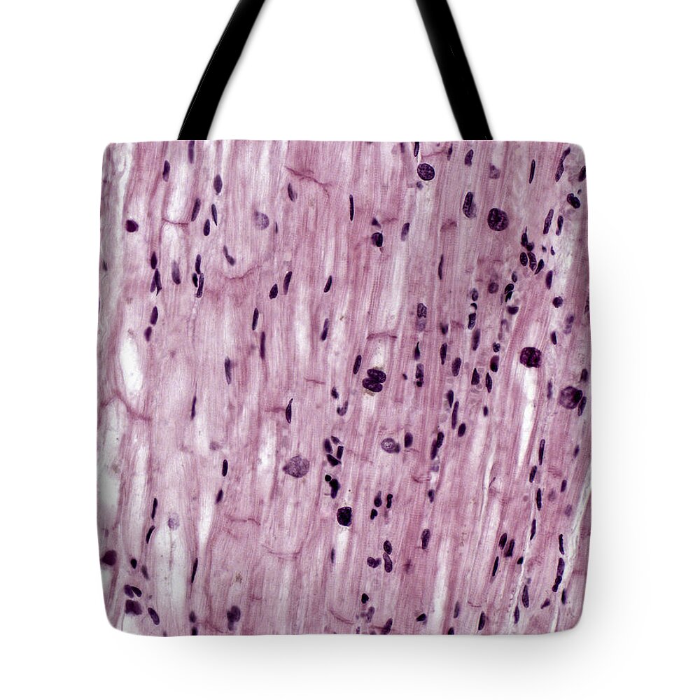 Cardiac Muscle Tote Bag featuring the photograph Cardiac Muscle With Purkinje Fibers, Lm #2 by Alvin Telser