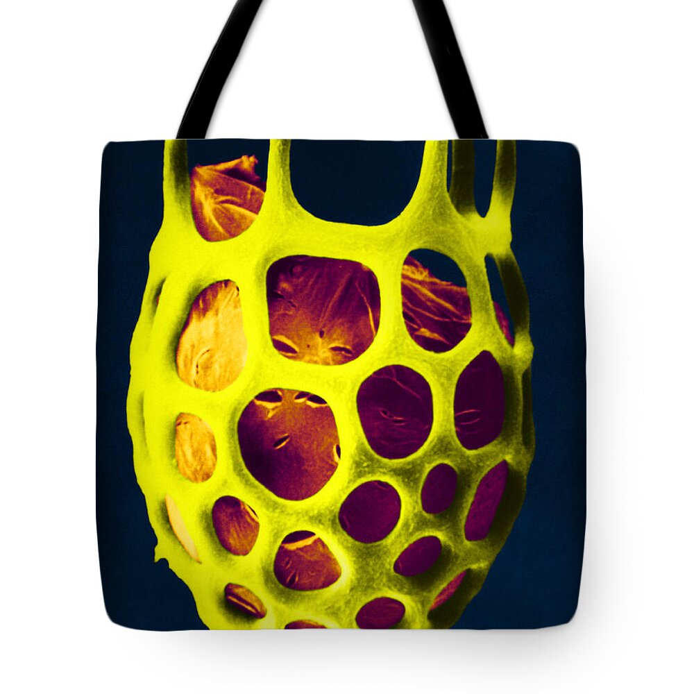 Science Tote Bag featuring the photograph Lorica Shell Of Unidentified Ciliate Sem #2 by Greg Antipa