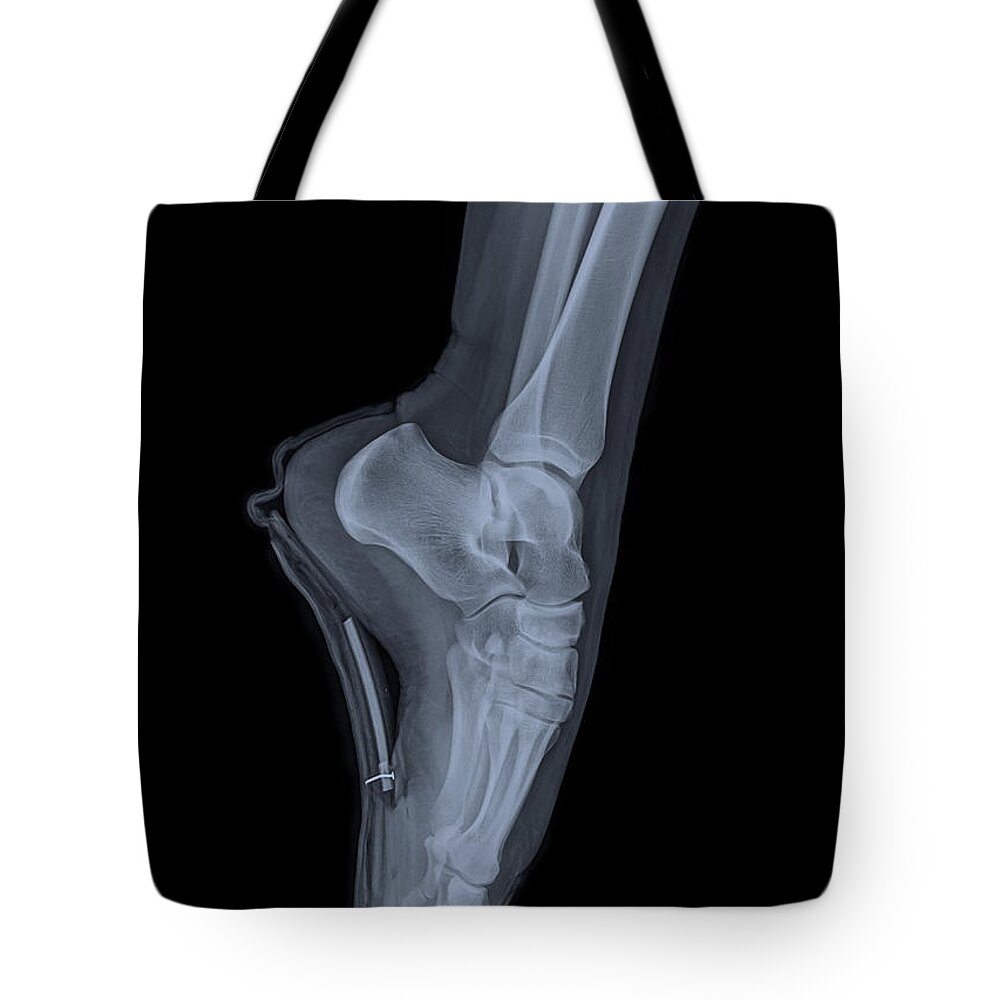 Point Tote Bag featuring the photograph Ballet Dancer x-ray 2 by Guy Viner