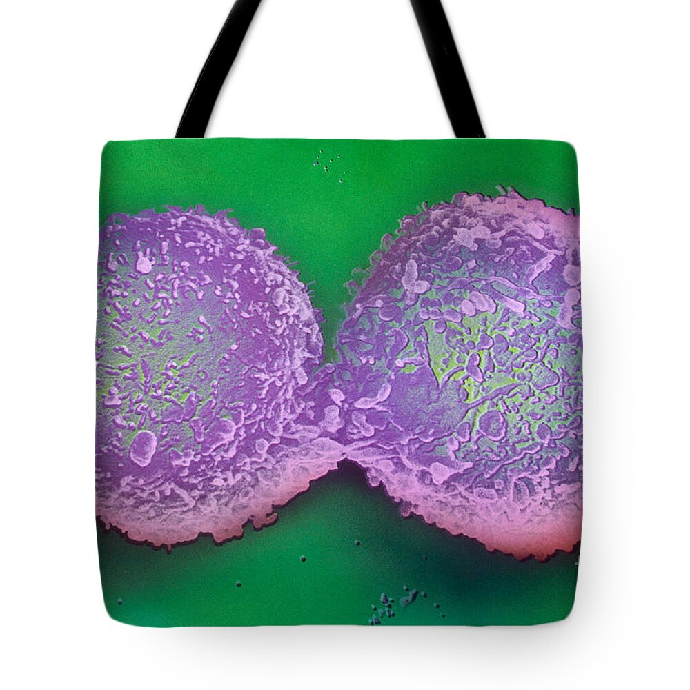 Lymphocyte Tote Bag featuring the photograph Dividing Lymphocyte Cells by David M. Phillips