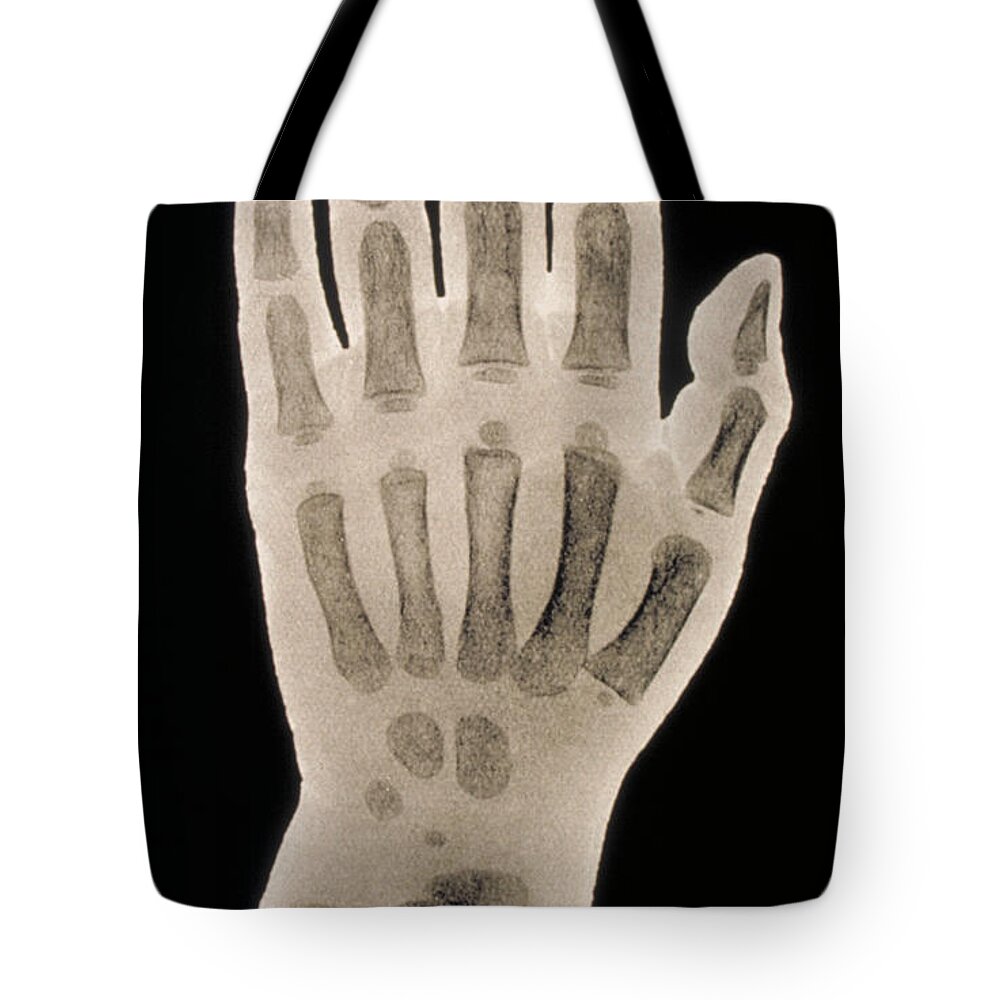 X-ray Of Hands Tote Bag featuring the photograph Hand X-ray Of A 2 Year Old Child by Scott Camazine