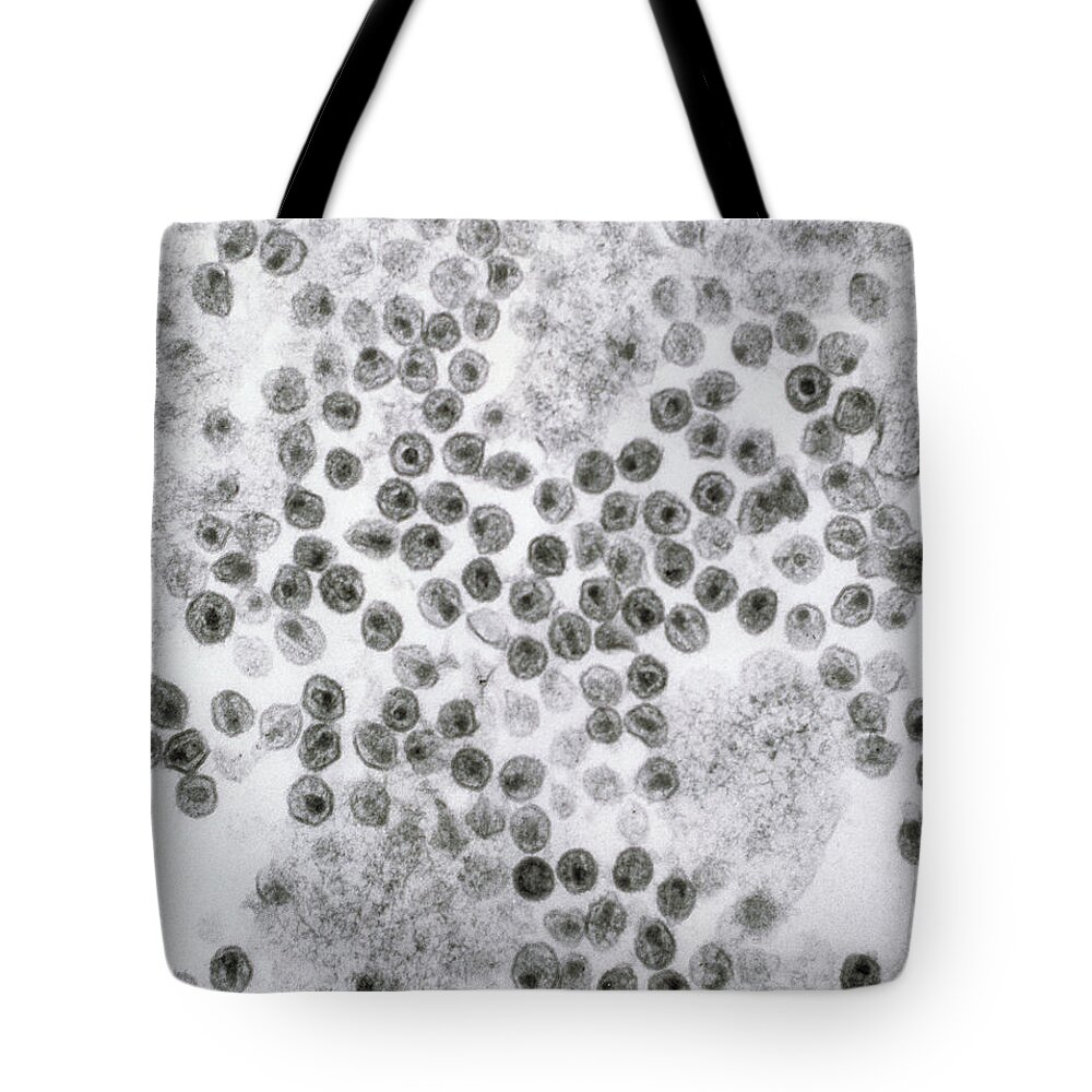 Hiv Tote Bag featuring the photograph Hiv Virus by David M. Phillips