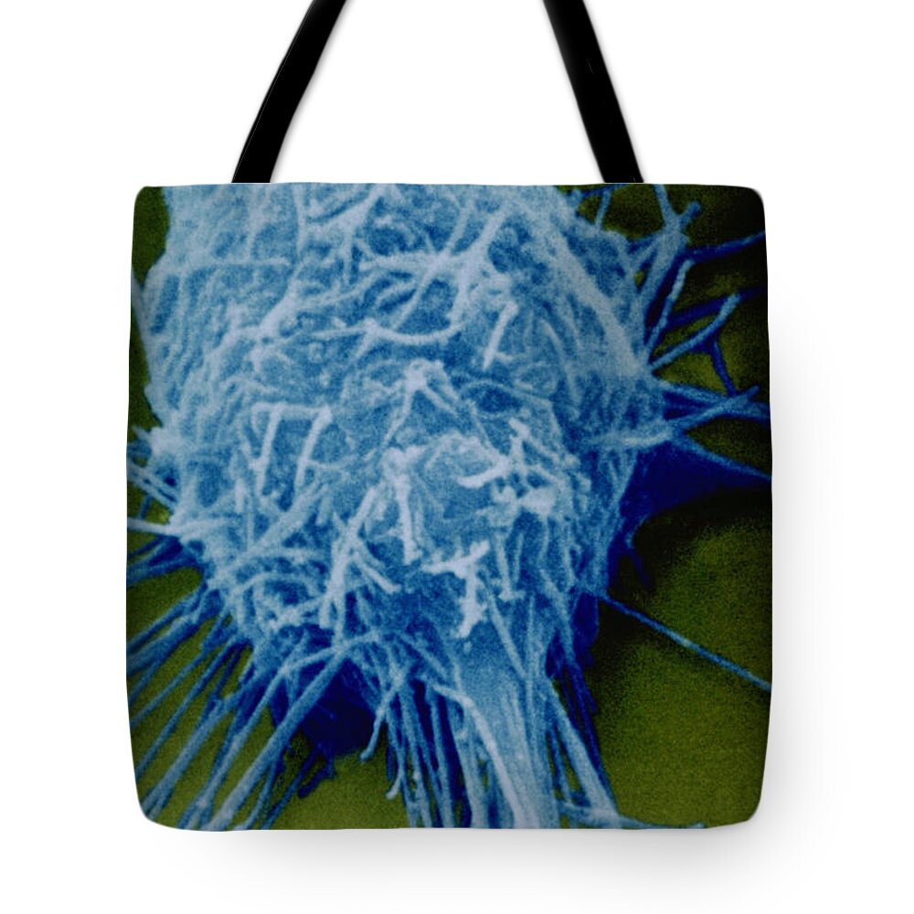 Color Enhanced Tote Bag featuring the photograph Neuroblastoma Cell by Biology Pics