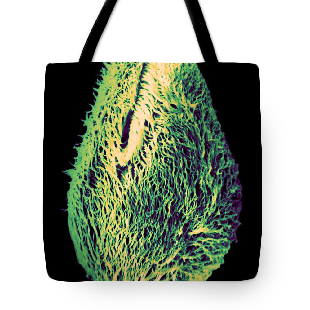 Science Tote Bag featuring the photograph Nyctotherus Ovalis Sem by Greg Antipa