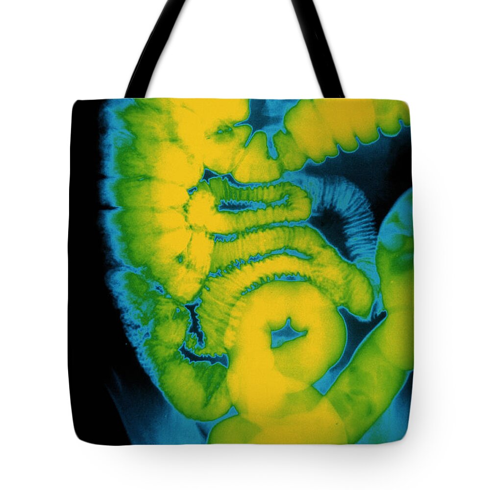 Barium X-ray Tote Bag featuring the photograph X-ray Of Large Intestine by Susan Leavines