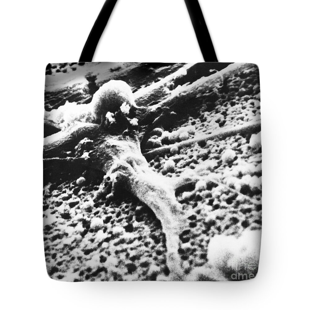 Cancer Tote Bag featuring the photograph Malignant Cancer Cell #1 by Omikron