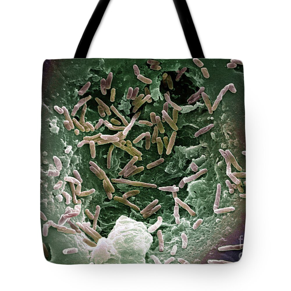 Bacteria Tote Bag featuring the photograph Mycobacterium Chelonae #1 by Science Source