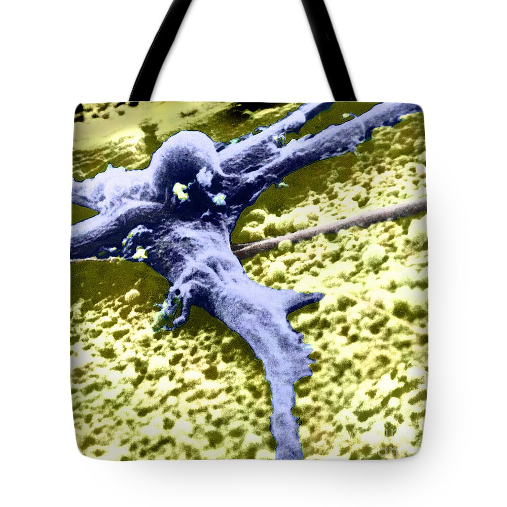 Cancer Tote Bag featuring the photograph Malignant Cancer Cell #4 by Omikron