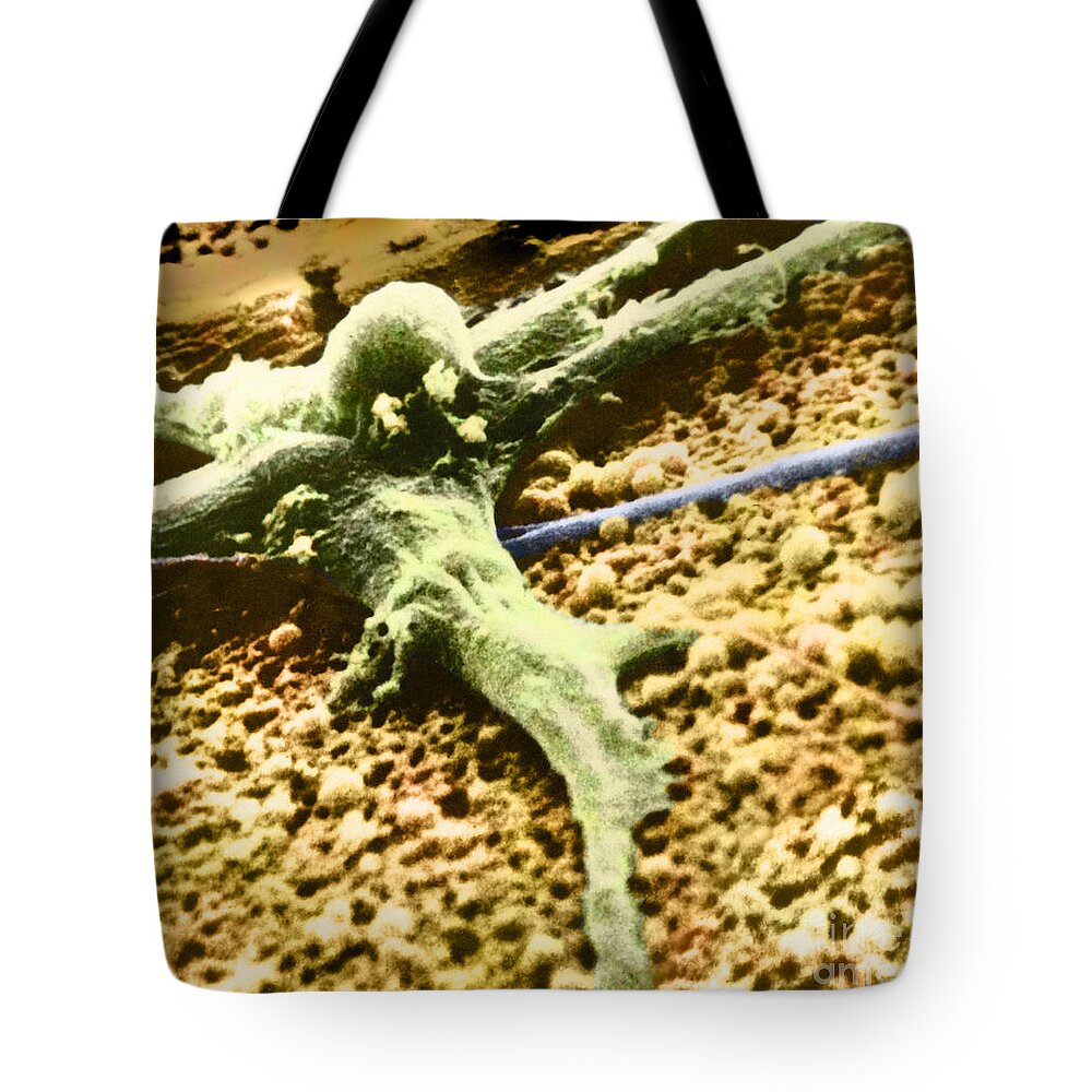 Cancer Tote Bag featuring the photograph Malignant Cancer Cell #5 by Omikron