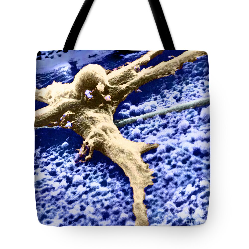Cancer Tote Bag featuring the photograph Malignant Cancer Cell #7 by Omikron