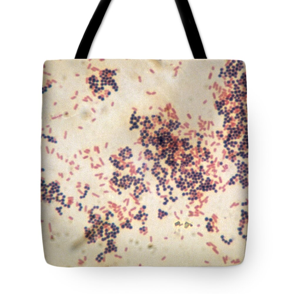 Negative Staining Tote Bags