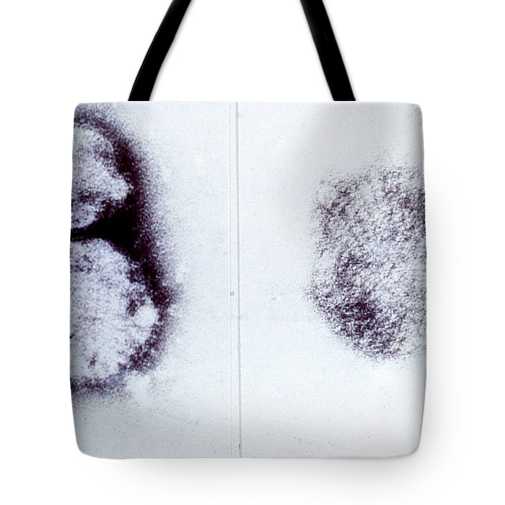 Medical Tote Bag featuring the photograph Hantavirus by Science Source