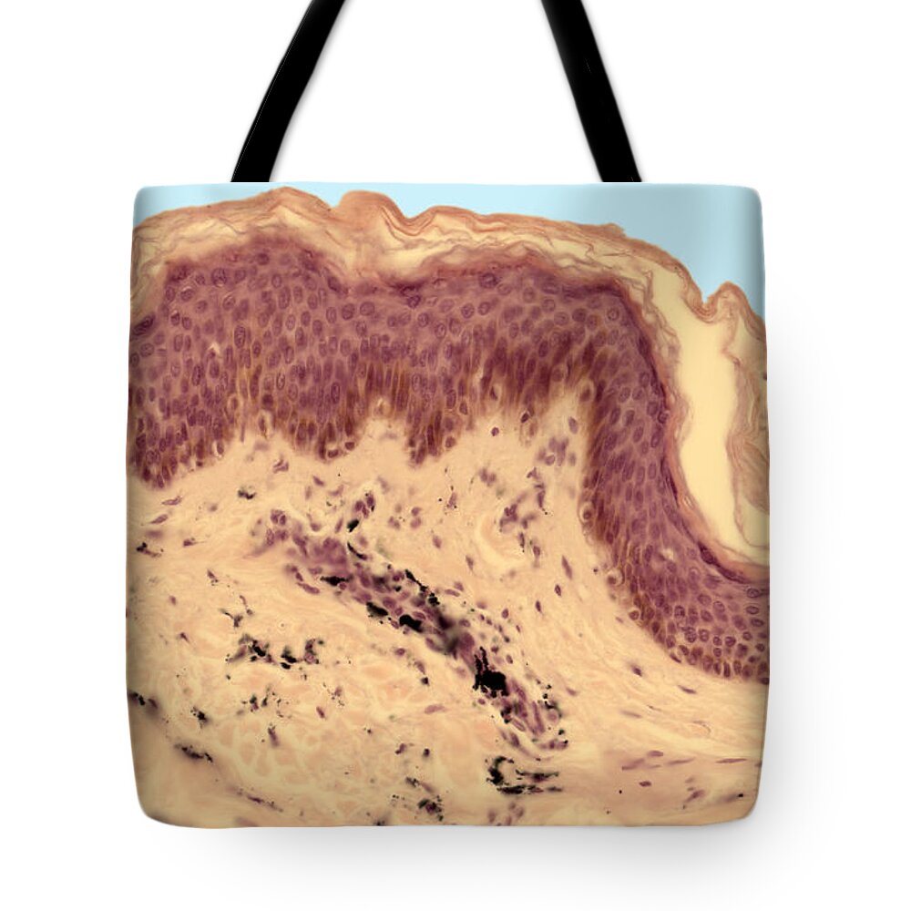 Human Body Tote Bag featuring the photograph Human Skin With Tattoo Ink, Lm #1 by Ted Kinsman