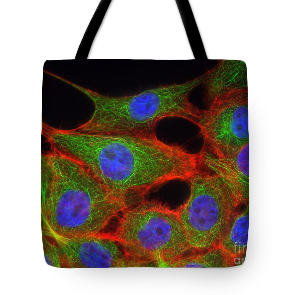 Science Tote Bag featuring the photograph Breast Cancer Cells, Fm #2 by Science Source