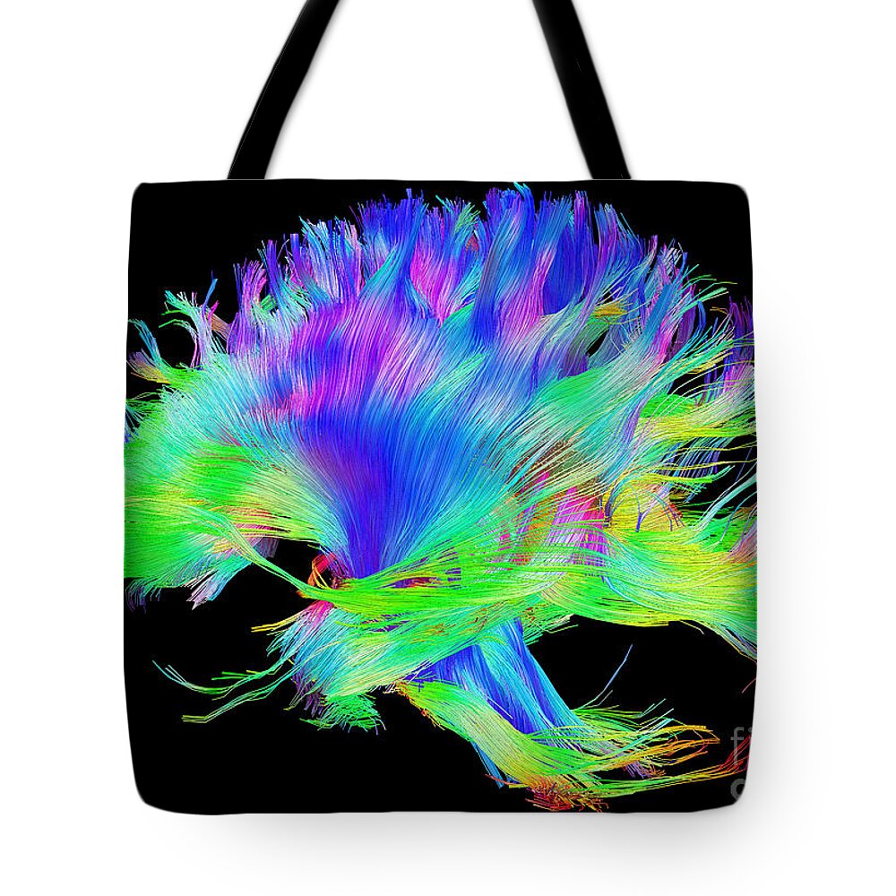 Brain Mri Tote Bag featuring the photograph Fiber Tracts Of The Brain, Dti by Living Art Enterprises