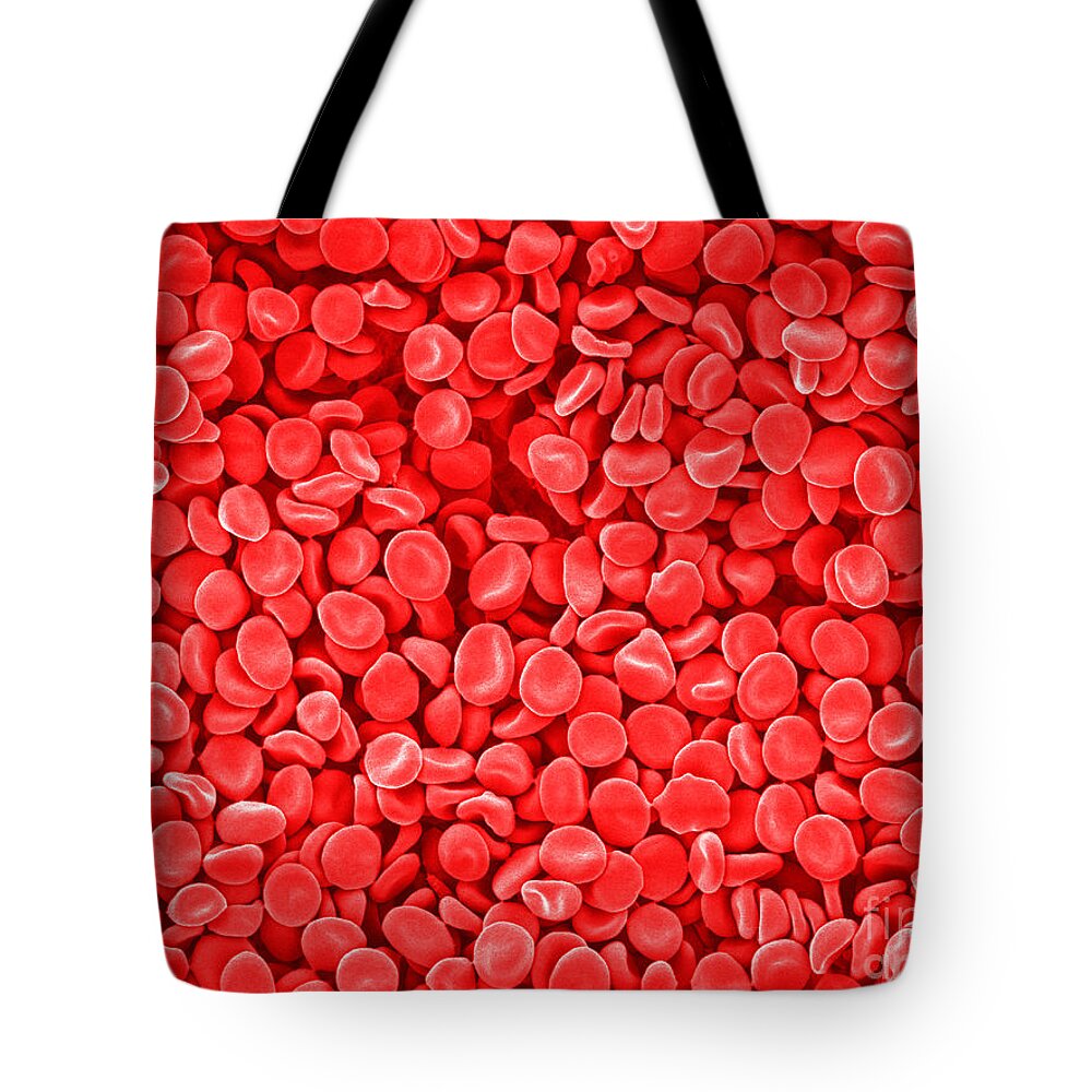 Red Blood Cells Tote Bag featuring the photograph Red Blood Cells, Sem #2 by Scimat