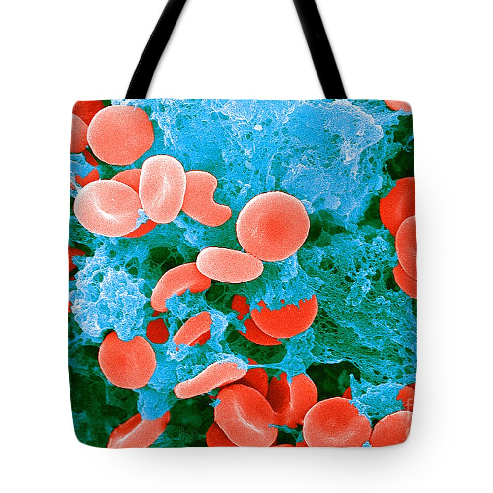 Biology Tote Bag featuring the photograph Red Blood Cells, Sem #7 by Science Source