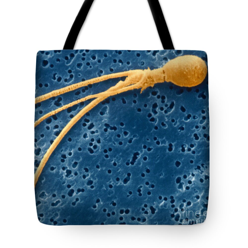 Abnormal Tote Bag featuring the photograph Abnormal Sperm by Scimat
