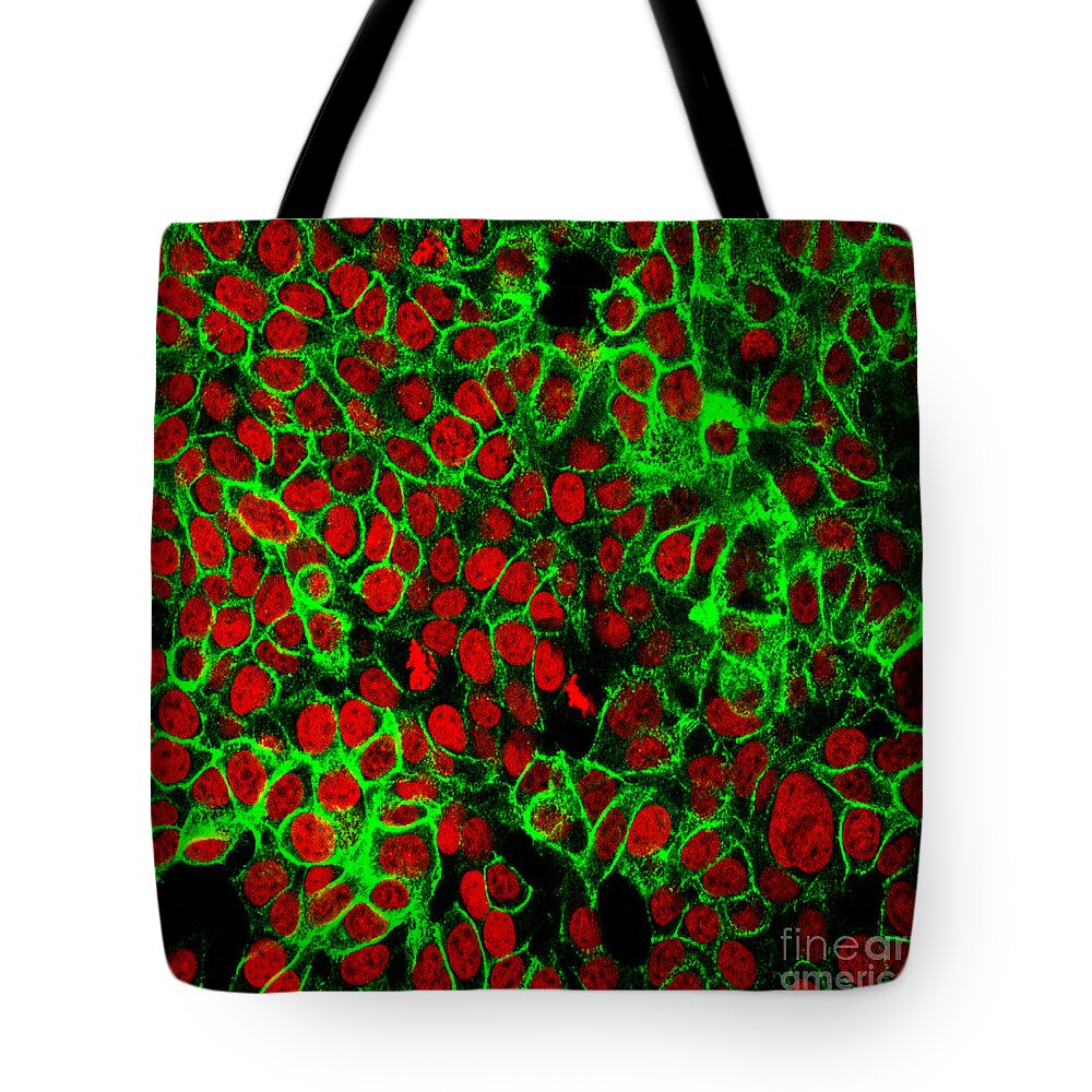 Science Tote Bag featuring the photograph Colon Cancer Cells, Fm by Science Source