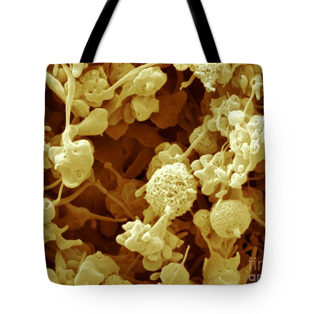 Sem Tote Bag featuring the photograph Excited Human Platelets by Scimat