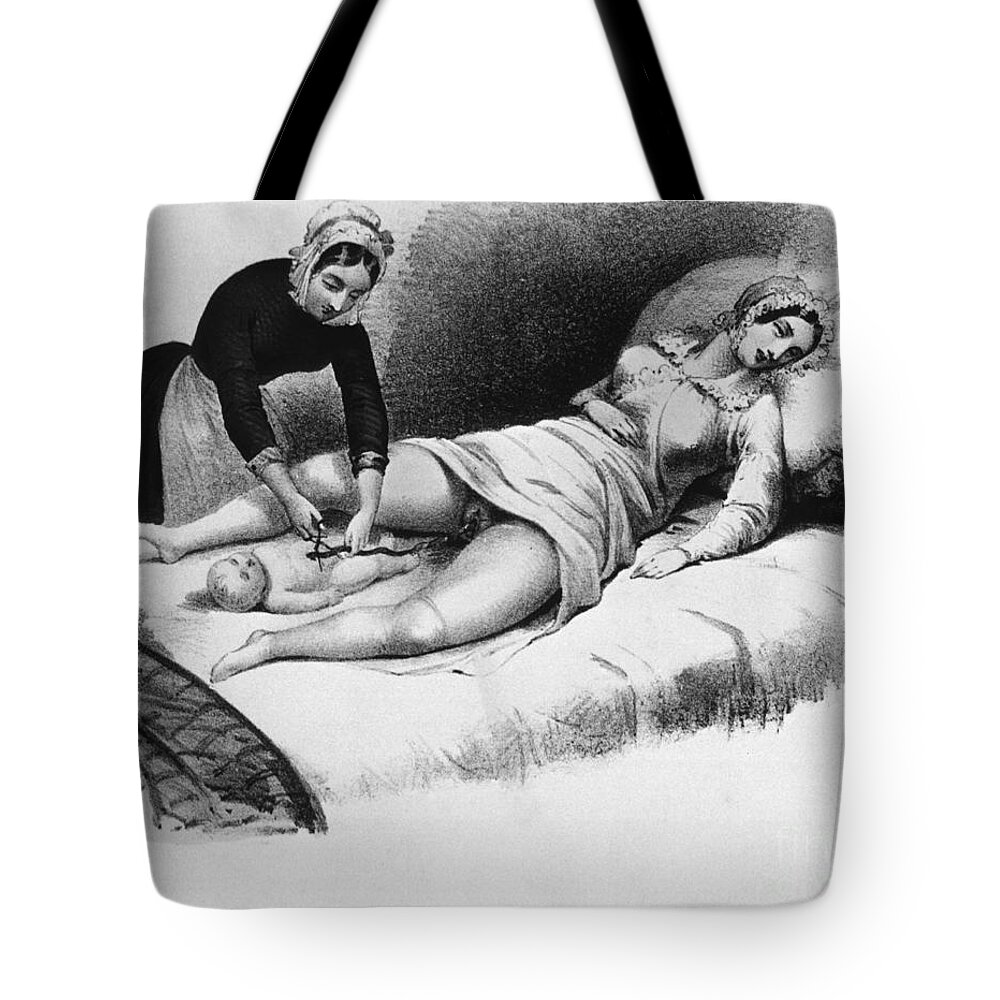 History Tote Bag featuring the photograph Midwife Cutting Umbilical Cord, 1850 by Science Source