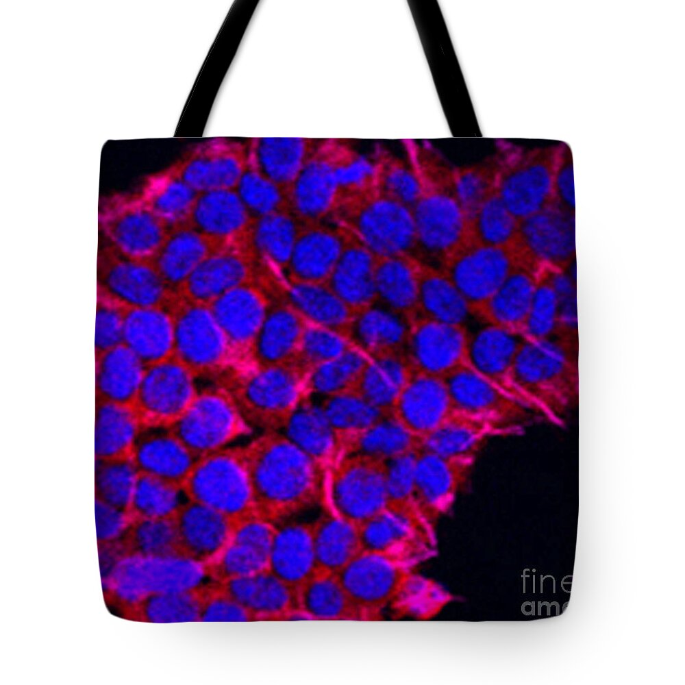 Science Tote Bag featuring the photograph Pancreatic Cancer, Confocal Microscopy by Science Source