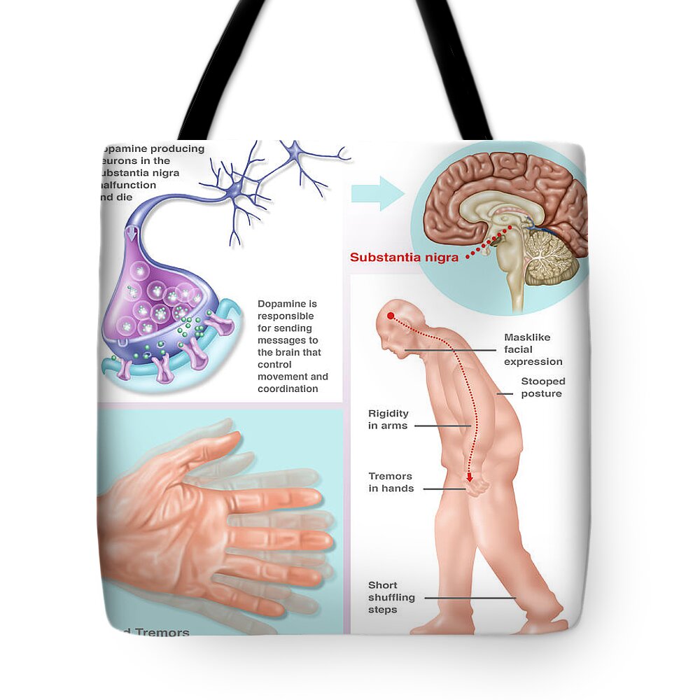 Illustration Tote Bag featuring the photograph Parkinsons Brochure, Illustration by Gwen Shockey