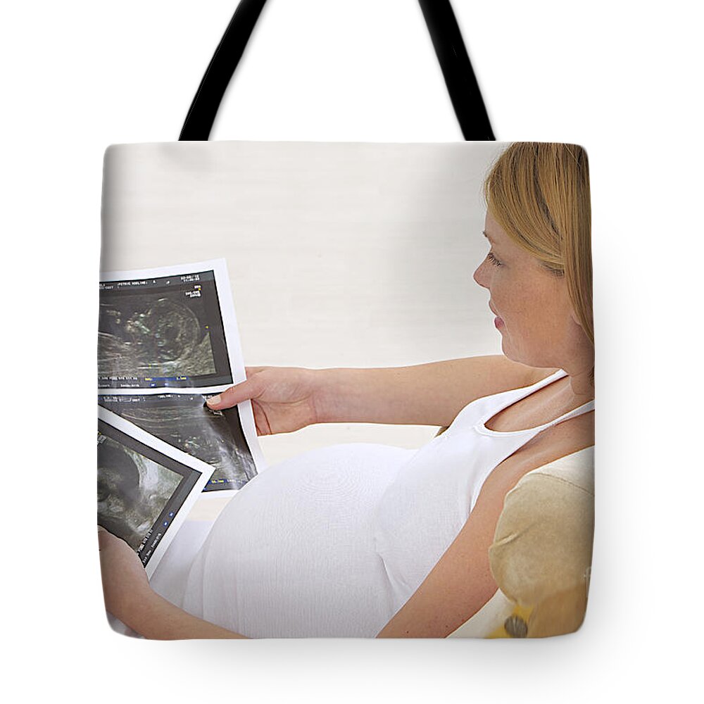 Examination Tote Bag featuring the photograph Pregnant Woman Looks At Ultrasonounds by Jean-Paul Chassenet