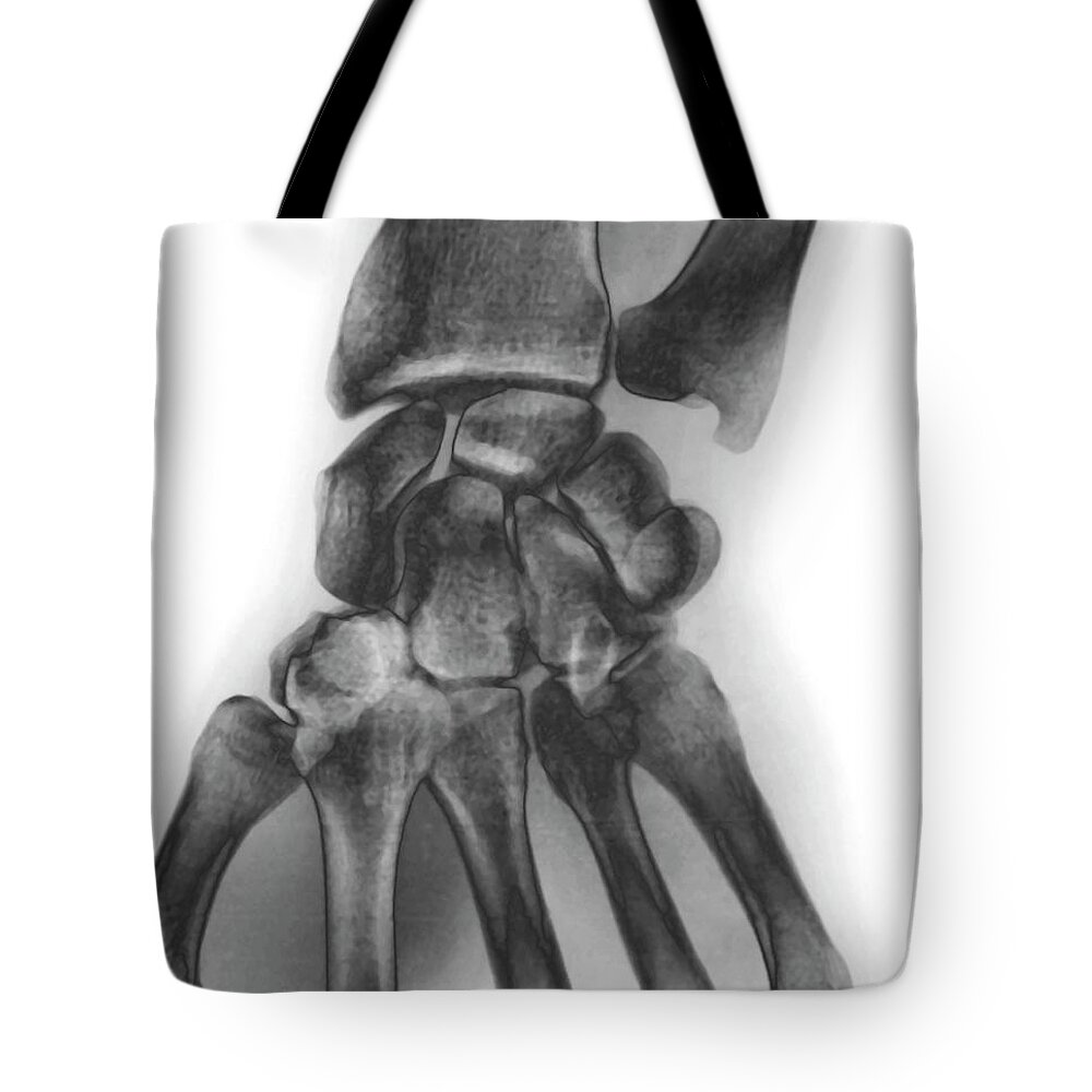 White Background Tote Bag featuring the photograph Normal Wrist, X-ray #1 by Zephyr