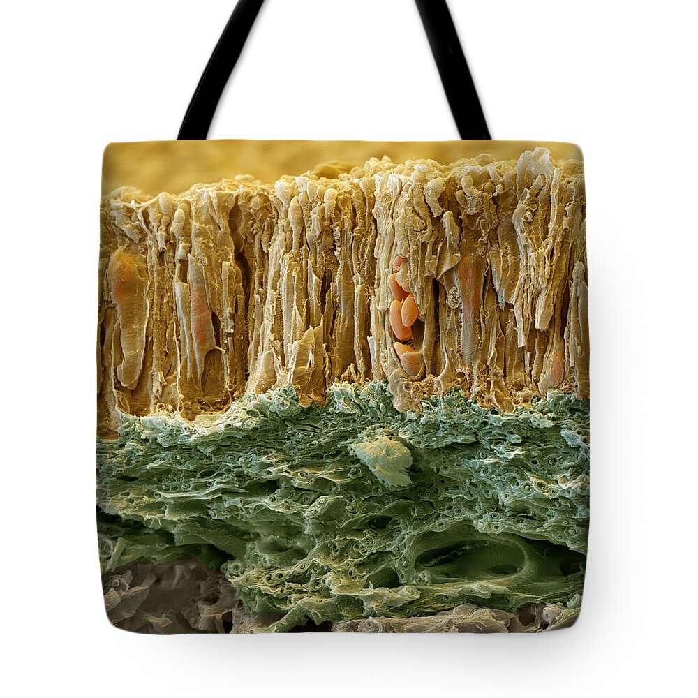 Algae Tote Bag featuring the photograph Common Orange Lichen #2 by Meckes/ottawa